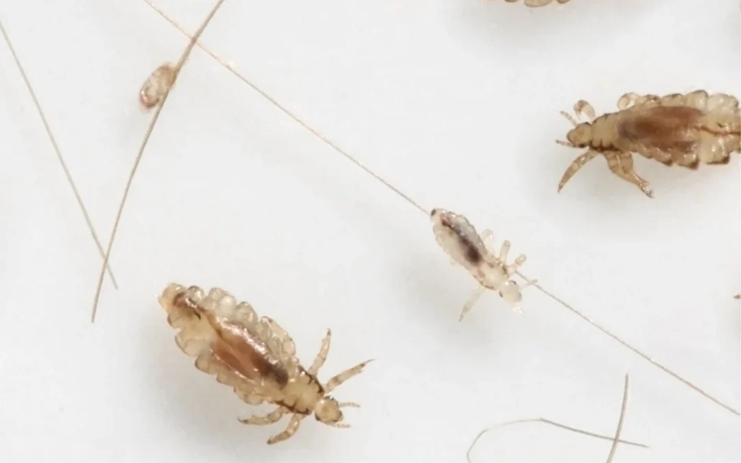 Physically Acting Treatments for Head Lice—Can We Still Claim They Are ‘Resistance Proof’?